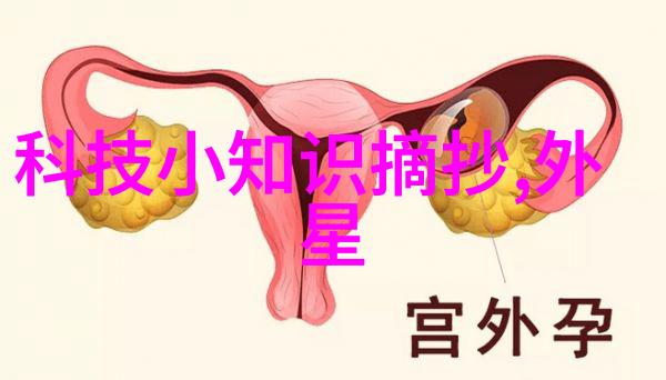 丝网填料750塔板从平凡的建筑材料到不凡的笑话源泉
